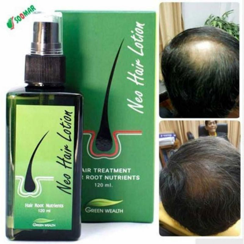 Neo Hair Lotion 120ml New Formula